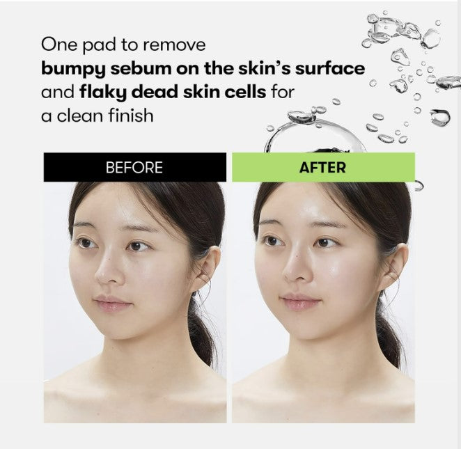 Reedle Shot Synergy Sparkling Toner Pad 200ml