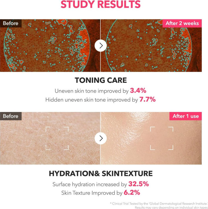 TXA Niacinamide 99 Milky Toner 150ml / 5.07 fl. oz.