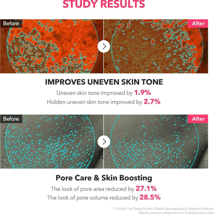 TXA Niacinamide Toning Shot 99 Spicule Facial Serum 1.01 fl.oz / 30ml