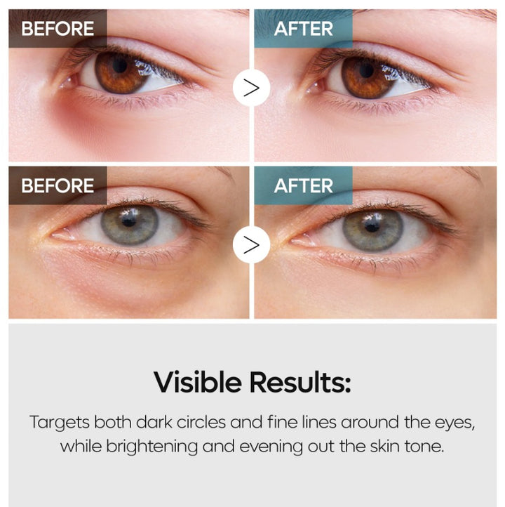 TX Retinalsome Double Effect Eye Cream 40ml