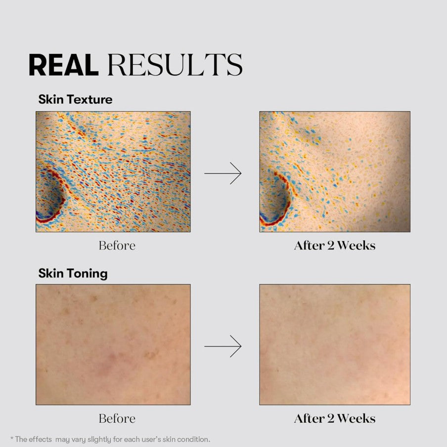 TX Toning Essence 1000 Shot 1.01 fl. oz. / 30ml