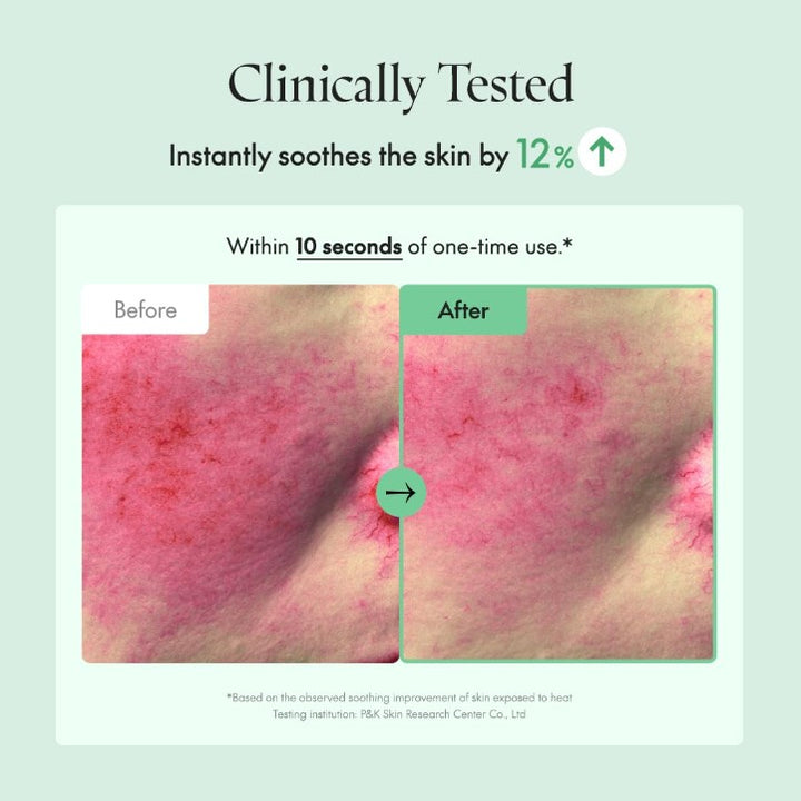 Wonder Releaf Centella Cream Unscented 50ml / 1.69 fl. oz.