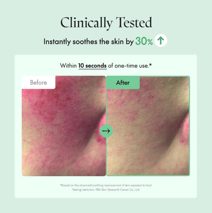 Wonder Releaf Centella Eye Cream Unscented 30ml / 1.01 fl. oz.