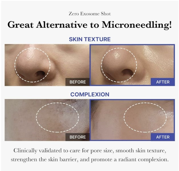 One-Day Exosome Shot Pore Ampoule 2000 30ml / 1.01 fl. oz.