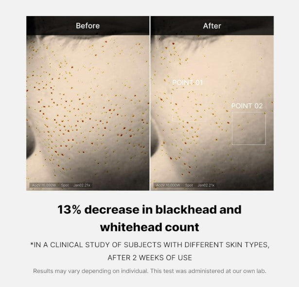 Zero Pore One-day Serum 30ml / 1.01 fl. oz.