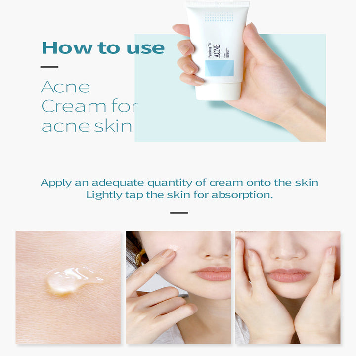 Acne Cream 1.69 fl. oz. / 50ml