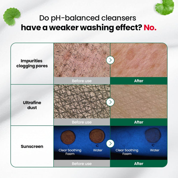 pH Cleansing R.E.D Blemish Clear Soothing Foam 150ml / 5.07 fl. oz.