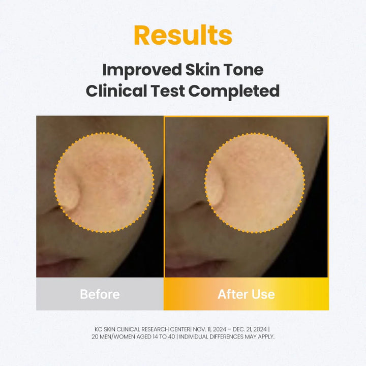 3D Vitamin C Niacinamide 5% Booster Serum 30ml / 1.01 fl. oz.