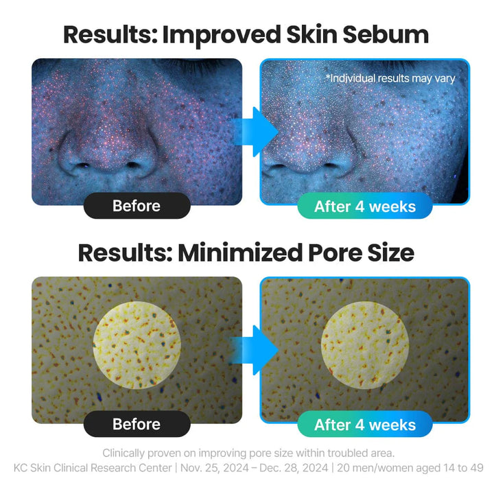 Red Blemish Clear Hyal Cica Soothing Serum 50ml / 1.69 fl. oz.