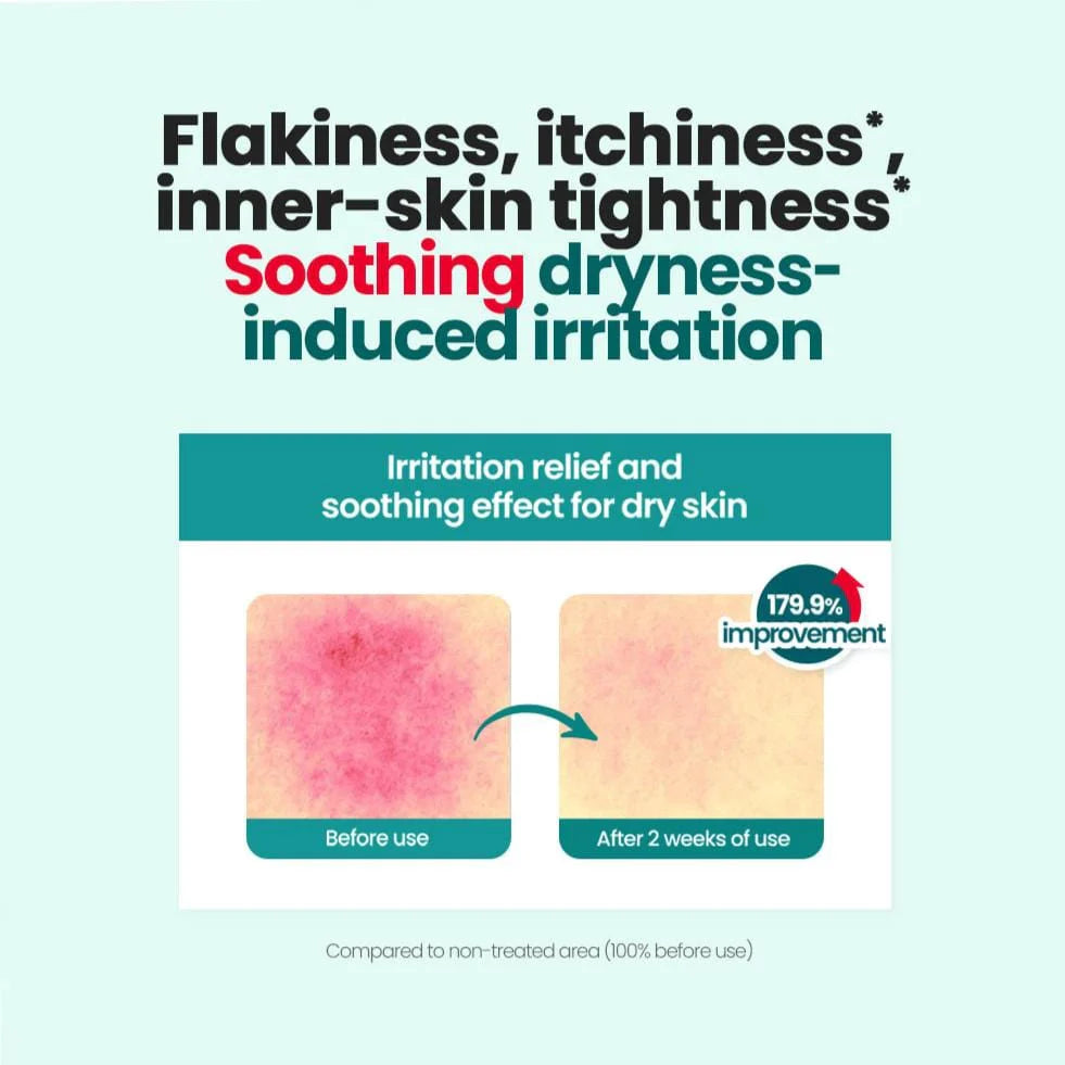 Red Blemish Clear Soothing Cream 70ml for Dry Skin