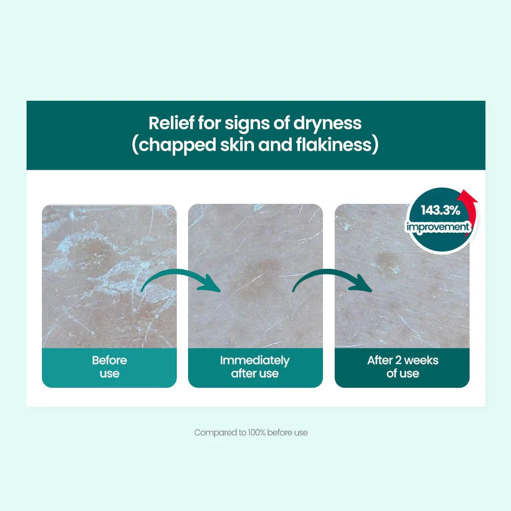 Red Blemish Clear Soothing Cream 70ml for Dry Skin