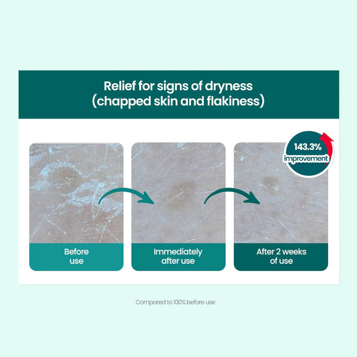 Red Blemish Clear Soothing Cream 70ml for Dry Skin