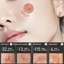 Anua Heartleaf + Centella Red Spot Cream 30g