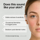 Azelaic Acid Serum 30ml