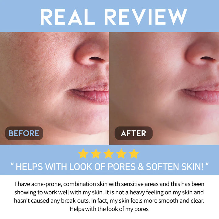 A+ AHA BHA Clarifying Serum 50ml / 1.69 fl. oz.