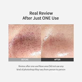 Sungboon Editor Blackhead Melting Clear Pad 30