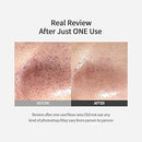 Sungboon Editor Sungboon Editor Blackhead Melting Clear Pad 30