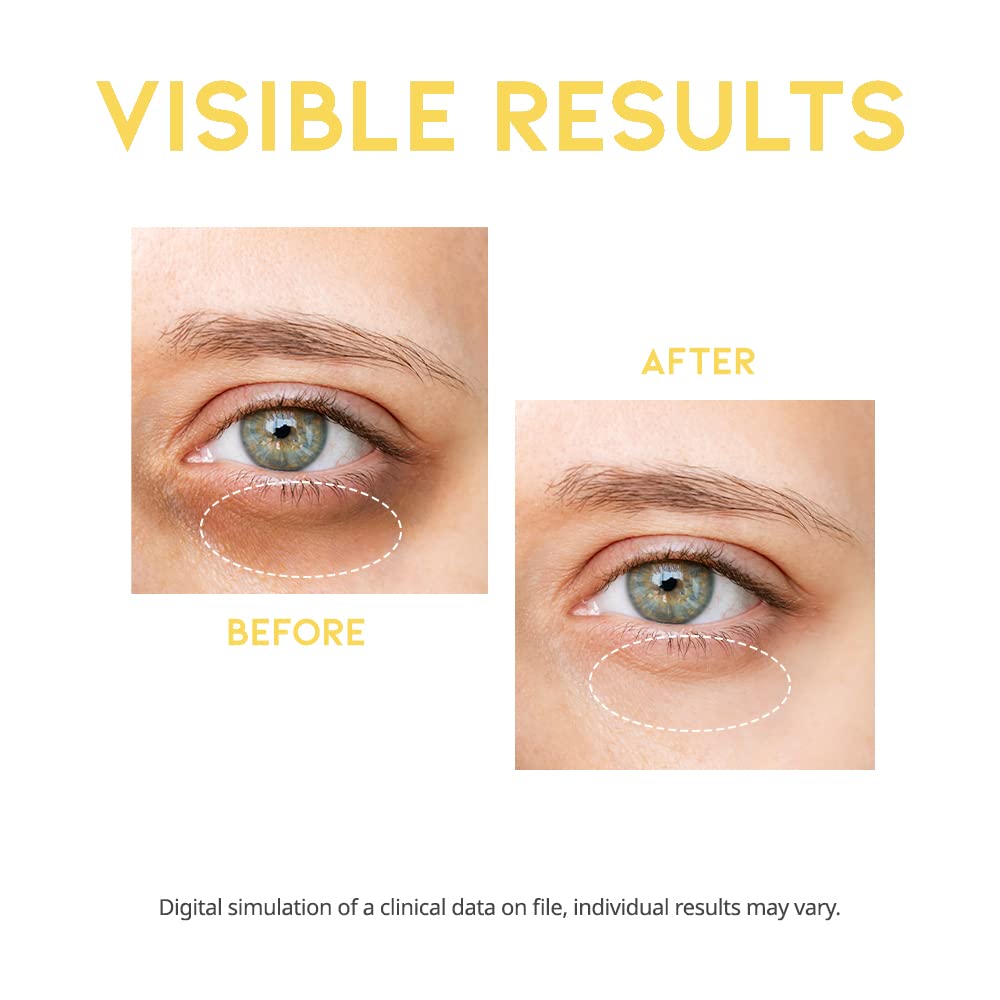 Dark Circle Remover Eye Serum 30ml / 1.01 fl. oz.