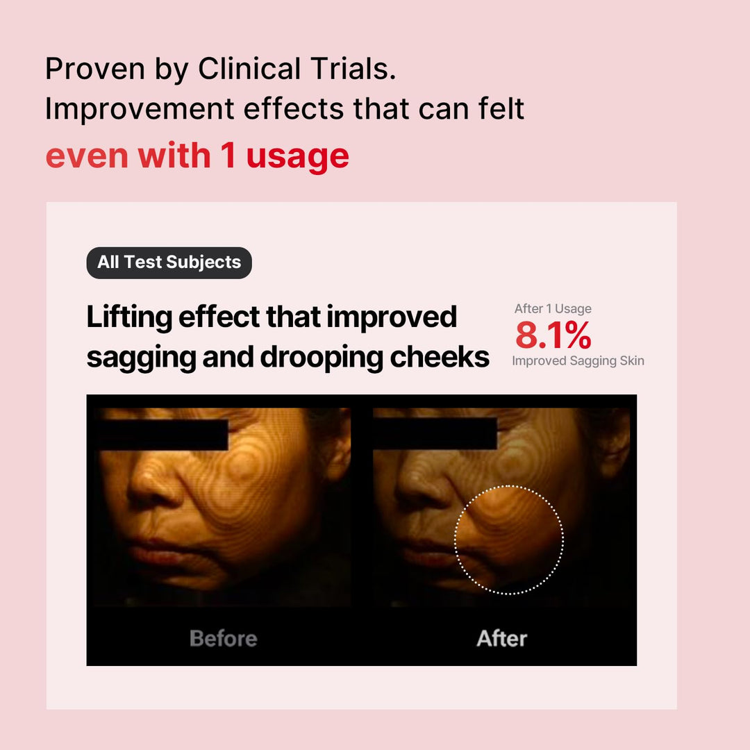 Shumage Gold Seal Lifting Cream 50ml with Shumage Device