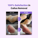 Foot Exfoliant Softener 100ml