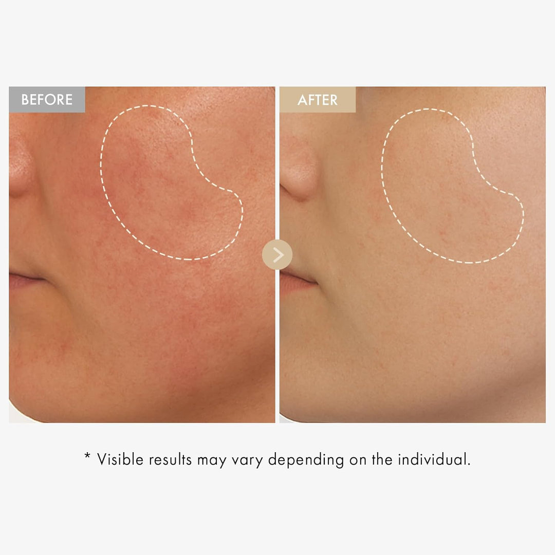 Vita Glow Niacinamide Serum 30ml