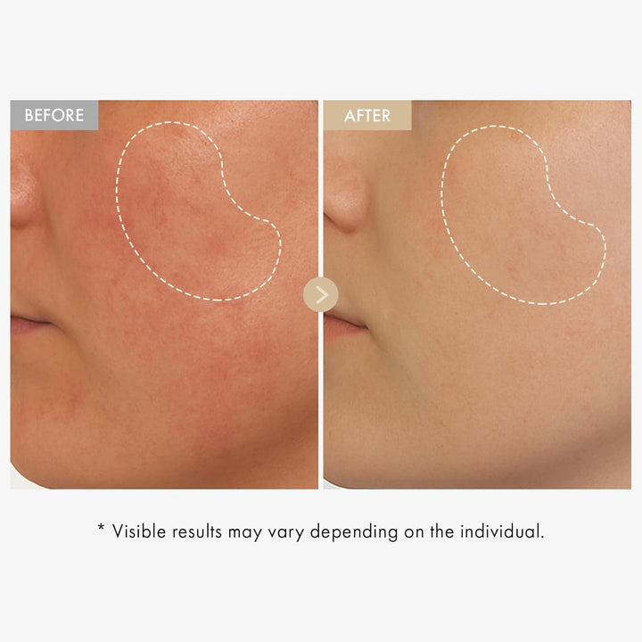 Vita Glow Niacinamide Serum 30ml