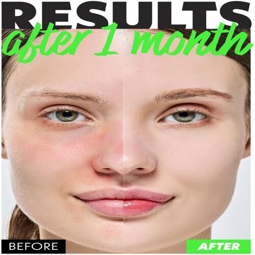 Nosca9 Trouble Clear Toner S 200ml