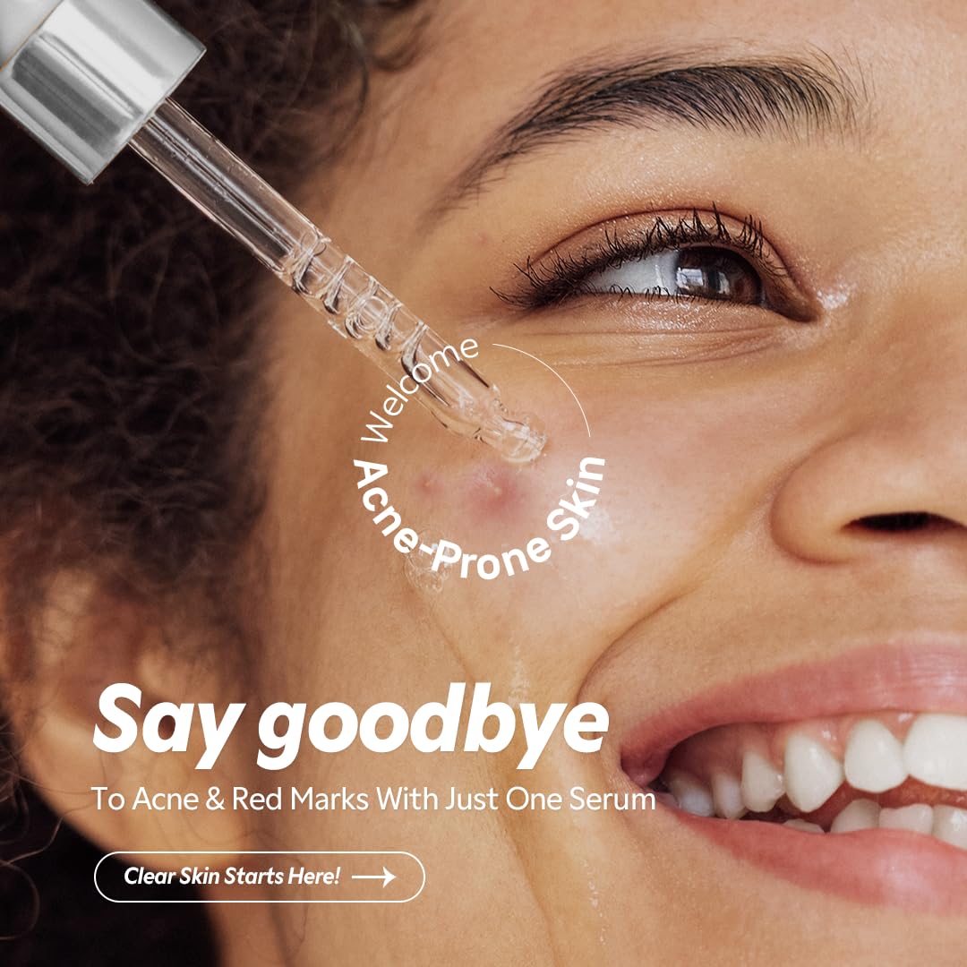 Azelaic Acid 12% Serum 30ml