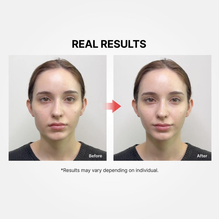 Shumage Gold Seal Lifting Cream 50ml with Shumage Device