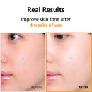 Isntree Hyper Vitamin C 23 Serum 20ml / 0.67 fl. oz.