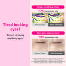 ISOI Blemish Care Eye & Wrinkle Patch 90g / 90pcs