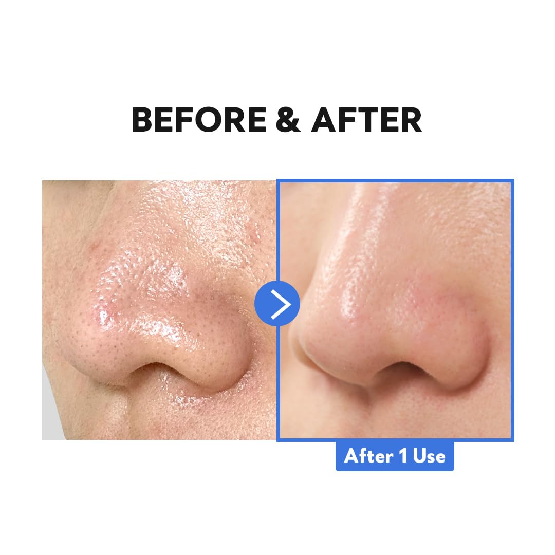 Hydro Boost Enzyme Cleansing Balm 0.3 fl. oz. / 9ml