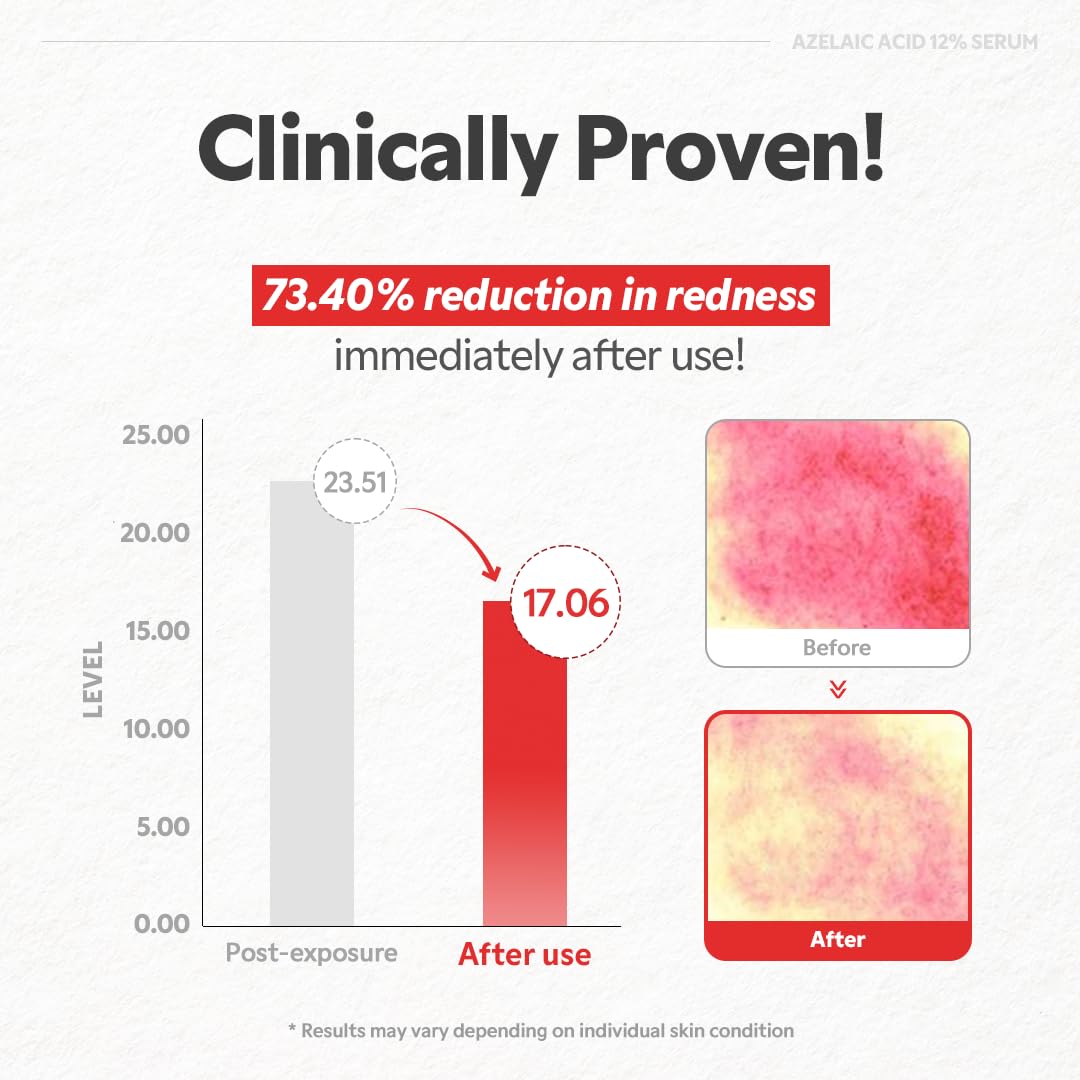 Azelaic Acid 12% Serum 30ml