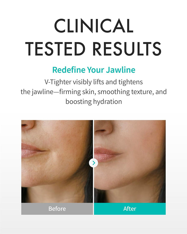 Perfect V Tighter c-PDRN® Dual-Sheet Lifting Sheet Mask 4pk