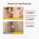 Kojic Acid Turmeric Peel Shot 80ml