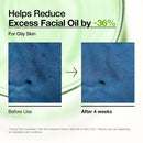 Azelaic Acid 10+ Hyaluron Redness Soothing Serum 30ml, 1.01 fl. oz.