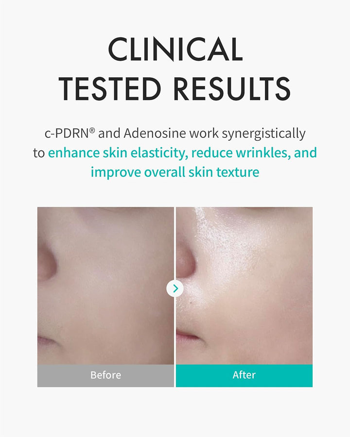 Turnover c-PDRN® Original Salmon DNA Sheet Mask 5pk