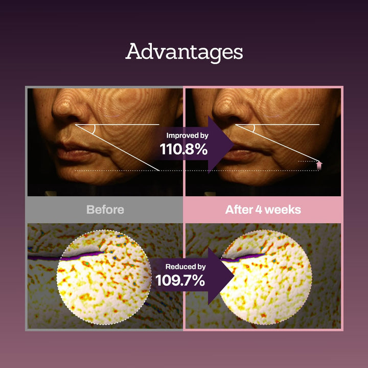 Collagen Peptide 12X Boosting Serum 30ml