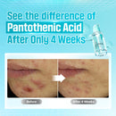 Numbuzin No.1 Pantothenic B5 Active Soothing Serum 50ml / 1.69 fl. oz.