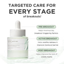 Azelaic Acid 10% Serum 30ml