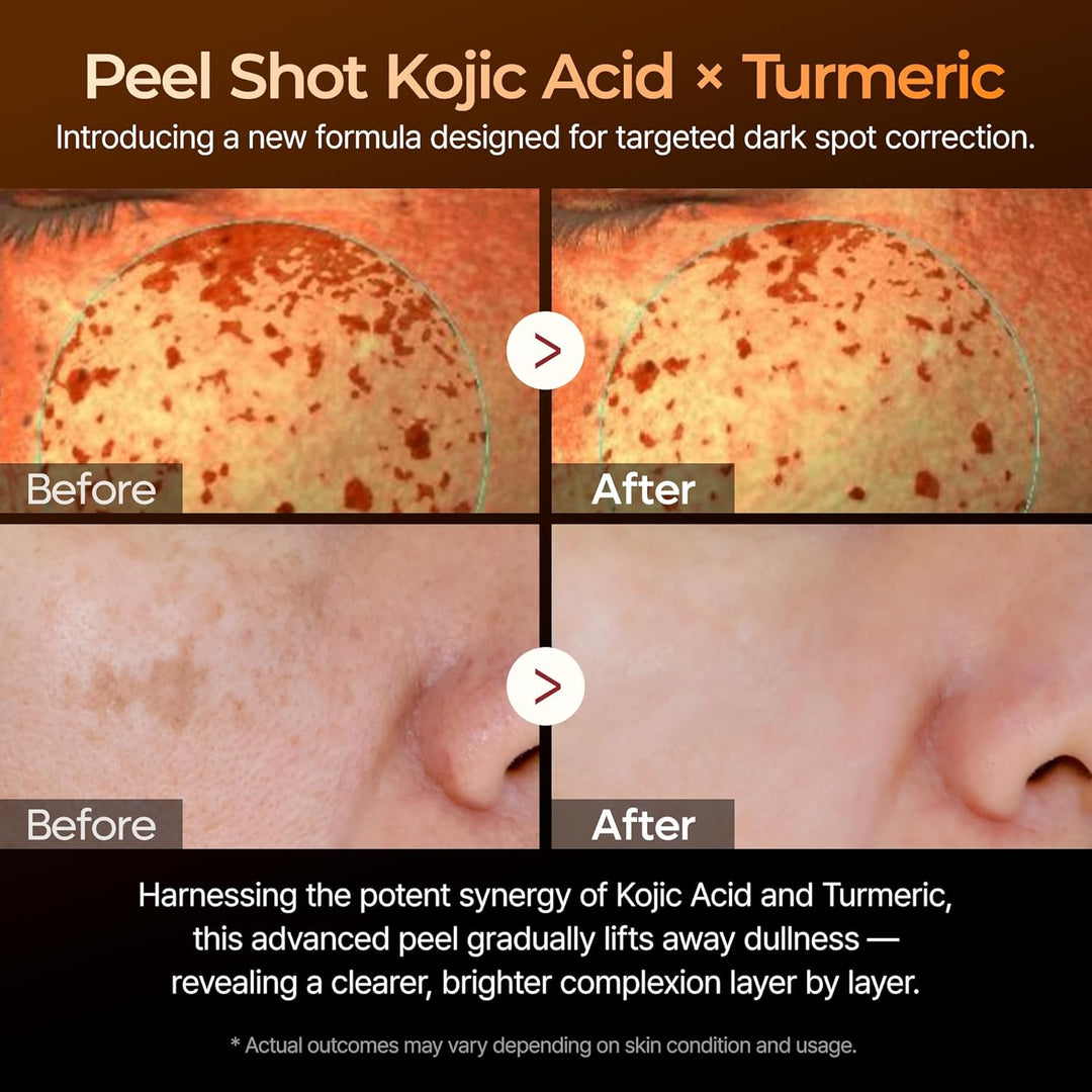 Peel Shot Kojic Acid Turmeric Peeling Ampoule 80ml / 2.7 fl. oz.