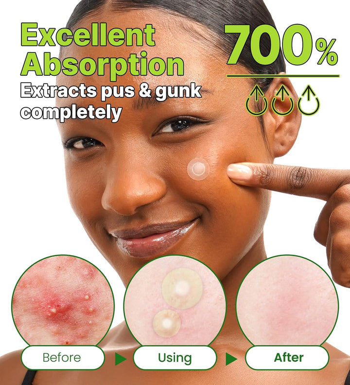 Invisible Spot Patch The Red Correct 96