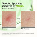 Azelaic Acid 10+ Hyaluron Redness Soothing Serum 30ml, 1.01 fl. oz.