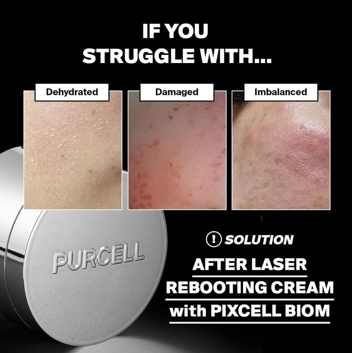 After Laser Rebooting Cream 1.69 fl. oz. / 50ml