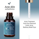Azelaic Acid 5% Serum 30ml / 1.01 fl. oz.