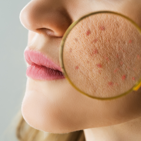 Calm Your Skin, Clear Your Glow