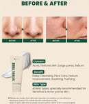 SEOUL 1988 Cleansing Foam : Pine Cica 1% + Probiotics 150ml / 5.07 fl. oz.