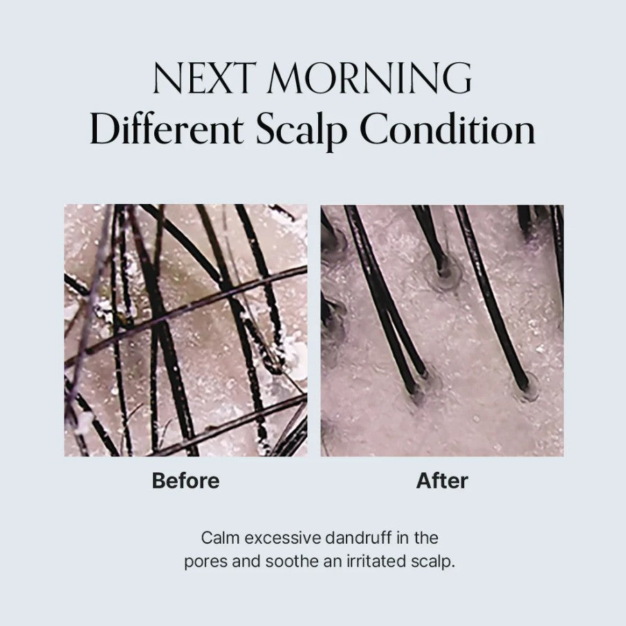 Damage Therapy Scalp Scaling Ampoule 50ml / 1.69 fl. oz.