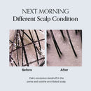 GROWUS Damage Therapy Scalp Scaling Ampoule 50ml / 1.69 fl. oz.