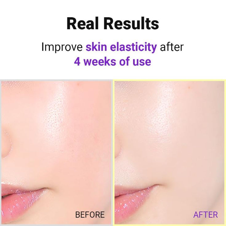 Hyper Retinol EX 1.0 Serum 20ml / 0.67 fl. oz.
